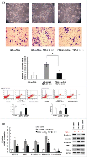 Figure 5. Knockdown of FOXQ1 partially inhibited TGF-β1-induced aggressive tumor behaviors in SW480 cells and the changes in expression of downstream genes. (A) NC- and FOXQ1-shRNA cells were incubated in growth media supplemented with TGF-β1 (3 ng/ml) for 3 days. FOXQ1 expression was measured by qRT-PCR and Western blot. (B) The culture supernatant from NC-shRNA cells cultured for 3 days or NC- and FOXQ1-shRNA cells cultured for 5 days containing TGF-β1 (3 ng/ml) was collected and used in an in vitro angiogenesis assay. The vessel formation was measured in NC-shRNA-transduced EA.hy926 cells. The number of vessels was counted by fluorescent microscopy (120X). (C) FOXQ1- and NC-shRNA cells were treated with TGF-β1 (3 ng/ml) for 5 days, and cell morphology was examined by optical microscopy (120X) (upper panel). For the invasion assay, FOXQ1- and NC-shRNA cells were pre-treated with TGF-β1 (3 ng/ml) for 3 days before being seeded in the upper chamber of Transwell. After 36 hours, the cells migrating through the insert membrane were fixed and stained by crystal violet. The number of migrated cells was counted by optical microscopy (120X) (lower panels). (D) For the drug sensitivity assay, FOXQ1- and NC-shRNA cells were incubated in TGF-β1-containing media (3 ng/ml) for 4 days, and 5-FU or L-OHP (100 μg/ml) was added to the cell culture for an additional 24 hours. Flow cytometry was performed to measure cell apoptosis. (E) Expression of Wnt downstream target genes and EMT-associated markers in TGF-β1 treated NC- and FOXQ1-shRNA cells were measured by qRT-PCR and Western blot. The results are expressed as mean ± SD *P < 0.05, **P < 0.01.