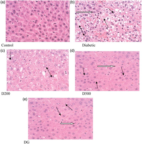 Figure 5. Histopathological changes (× 400) in liver of control and alloxan-induced diabetic rats. Control: normal histological structure of rat liver. Diabetic: degeneration (white arrow), fatty deposition (black arrow), cellular swelling and necrotic cells (double black arrow). D200: mild granular degeneration and swelling (black arrow), narrowed sinusoidal capillaries (double black arrow). D500: reduced fatty change (black arrow) and mild sinusoidal congestion (white arrow), mild granular degeneration (double black arrow). DG: degenerative cells reduced (black arrow) moderate hyperplasia (white arrow).