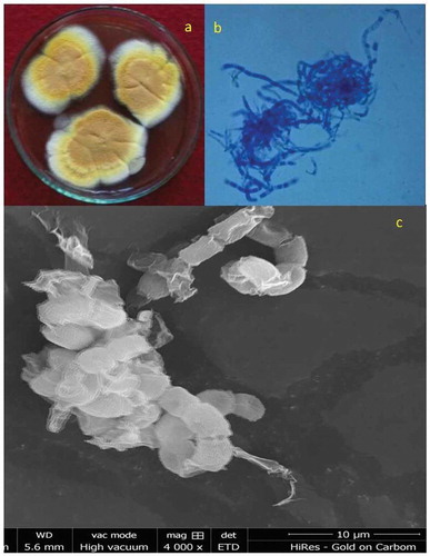 Figure 1. Locally isolated M. cinnamomea NFCCI 3724 under scanning electron microscopy showing structural morphologies.