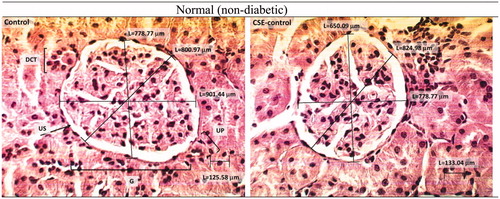 Figure 4. H & E stained optical micrographs of kidney tissue morphology of normal non-diabetic rats before (Control) and after (CSE-control) treatment with chicory (×400). G: glomerulus; US, urinary space; DCT: distal convoluted tubules; UP: urinary pole.