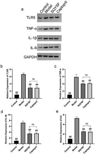 Figure 4. SQYSF inhibited the TLR5 Signaling Pathway in the kidney of CKD mice. (a) Western blot detection on the protein expressions of TLR5 and TNF-α, IL-1β and IL-6. (b–e) qPCR detection on the mRNA expressions of TLR5 and TNF-α, IL-1β and IL-6. ##, p < 0.01, which was compared with model group. ns, p > 0.05, SQYSF compared with captopril group.