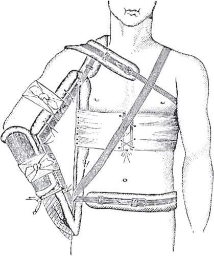 Figure 13. Middledorpf’s triangle. Reprinted from CitationStimson (1899) 102.