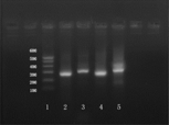 Figure 3 RT-PCR electrophoresis results. 1 lane: DNA maler; 2 and 4 lanes: GFAP; 3 and 5 lanes: S100. The deviced GFAP sequence to be amplified was about 270 bp, and the S100 sequence was about 300 bp.