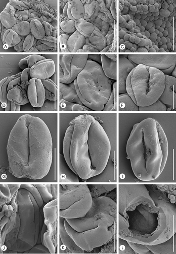 Figure 4. Erdtmanitheca portucalensis sp. nov. from the Early Cretaceous of Portugal. SEM-micrographs of Eucommiidites-type pollen grains isolated from holotype and paratype. A, B & D. Group of pollen grains isolated from the paratype showing well-defined distal colpus flanked by two subsidiary colpi in the equatorial plane (P0185). C. Orbicules (Ubisch bodies) spaced on the sporangium wall (P0185). E. Pollen grain isolated from the holotype showing wall with perforations on the proximal surface between the lateral colpi. F–I. Pollen grains isolated from paratype showing psilate wall surface and margins of apertures (P0185). J. Pollen grain isolated from the holotype showing perforations along the margins of the main colpus (P0186). K. Pollen grain, isolated from the holotype, in equatorial view showing colpi (P0186). L. Fragmented pollen grain isolated from the holotype showing wall stratification and details of aperture structure (P0186). Scale bars – 20 μm (A, J); 25 μm (B, D); 5 μm (C, L, M); 10 μm (E–I).