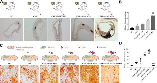 Figure 5 CML-induced SMCs-derived MVs promoted calcification. (A) Plaque calcification was detected by vonkossa staining. (B) Calcium content of the aorta in each group was compared. *P<0.05, compared with NC group. #P<0.05, compared with CML group. (C) Calcification of MOVAs was detected by alizarin red staining. (D) Image J software measured the ratio of the calcification area of MOVAs to the total area in a 10x field of view. *P<0.05, compared with NC group. #P<0.05, compared with CML group. NS, P>0.05, compared with NC group.