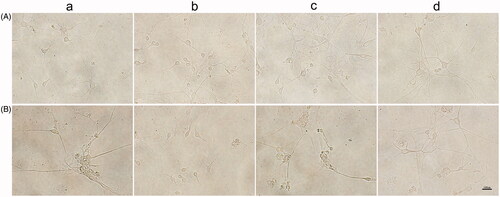 Figure 3. Growth of neuronal cells under hypoxia. (A) Before low oxygen treatment. (B) After resuscitation; a, non-heparin treatment group with resuscitation for 3 d; b, heparin treatment group with resuscitation for 3 d; c, non-heparin treatment group with resuscitation for 6 d; d, heparin treatment group with resuscitation for 6 d. Scale bar: 100 μm.