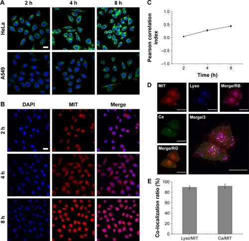 Figure 3 (A) In vitro cellular uptake of C6-loaded PL/ACC nanoparticles in HeLa and A549 cells as a function of incubation time (2, 4, and 8 hours). (B) Time-dependent intracellular drug localization of PL/ACC-MIT nanoparticles in HeLa cells. (C) Calculation of time-dependent Pearson correlation index between blue (nucleus) and red (MIT) signals. For each panel, blue: Hoechst 33342-stained nuclei; green: C6 indicated nanoparticles; red: MIT. (D) Intracellular trafficking of PL/ACC-MIT nanoparticles in HeLa cells at 4 hours post-incubation. For each panel, Ca: Fluo-4 AM indicated Ca2+ (green); Lyso: LysoTracker Blue-stained endolysosome (blue); MIT: MIT (red); Merge/RB: merge of MIT and endolysosome (purple); Merge/RG: merge of MIT and Ca2+ (yellow); Merge/3: merge of all three colors. (E) Calculation of co-localization ratio between different channels. Results were expressed as mean ± SD (n=3). Scale bar: 20 µm.Abbreviations: ACC, amorphous calcium carbonate; C6, coumarin-6; MIT, mitoxantrone; PL, phospholipid.