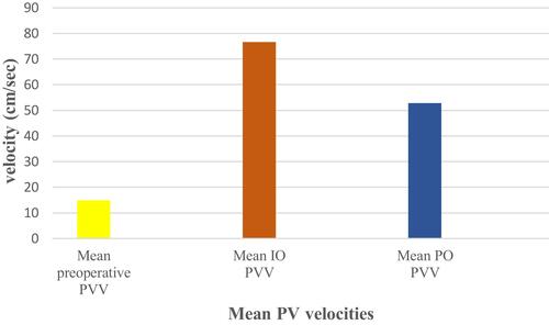 Figure 1 Mean PVV in the studied patients in the perioperative period.