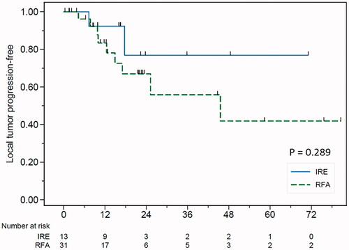 Figure 3. Local tumor progression-free survival in the IRE and RFA groups.