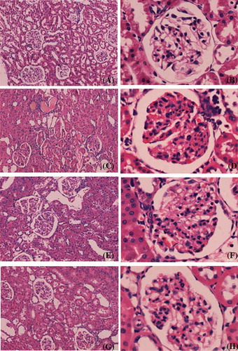 Figure 4. Representative light micrographs of kidney sections, stained with hematoxylin and eosin technique: (A and B) sham group; (C and D) model group; (E and F) SFSG group; (G and H) SFSG + atropine group. Magnifications: ×100 in (A, C, E, and G); ×400 in (B, D, F, and H).