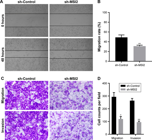 Figure S2 MSI2 promotes the migration and invasion of extrahepatic cholangiocarcinoma.