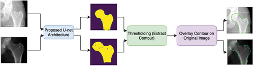 Figure 2. Proposed CNN strategy to automatically detect the contour. First, the input images are applied to the proposed U-net architecture, which will output the predicted masks of each image. Then by applying thresholding, the contour is extracted and is then overlayed on the original input image.