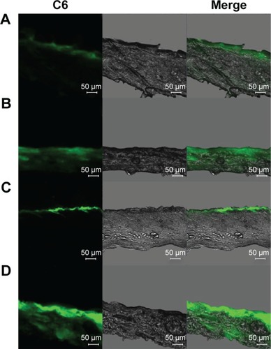 Figure 6 Confocal laser scanning microscopy of skin sections of Sprague Dawley rats after 4 hours of in vivo administration of (A) C6 aqueous suspension, (B) C6–NIC complex suspension, (C) C6–HA–Chol–NP suspension, and (D) C6–HA–Chol–NPs–NIC suspension.Notes: The concentration of C6 in each formulation was 1 mg/mL, and the green fluorescence represented C6. Scale bar: 50 μm. Magnification ×100.Abbreviations: C6, coumarin 6; C6–HA–Chol–NPs, coumarin 6-loaded hyaluronic acid–cholesterol nanoparticles; C6–HA–Chol–NPs–NIC, coumarin 6-loaded hyaluronic acid–cholesterol nanoparticles containing nicotinamide; C6–NIC complex, coumarin 6–nicotinamide complex; h, hours.