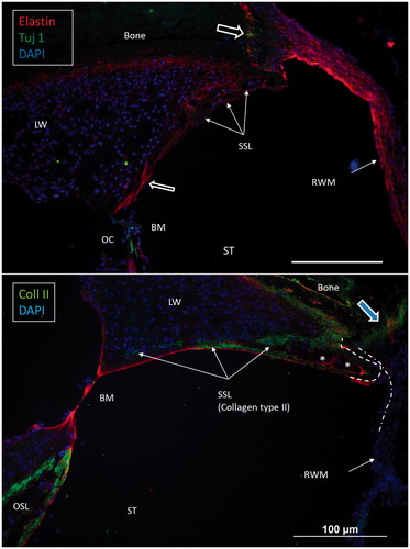 Figure 5. Confocal immunohistochemistry of the human cochlea at the level of the RW. Upper image: The RWM expresses elastin. Some elastic fibers radiate between the BM and the SSL. Lower image: The SSL expresses type II collagen. The OSL also expresses type II collagen. (For abbreviations, see legend to Figure 1).
