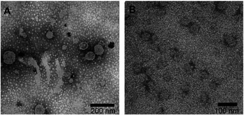 Figure 4 Observation of HBc-N144-NspA and HBc-N144 by TEM. (A) Magnified image of HBc-N144-NspA. (B) A magnified image of HBc-N144.Abbreviations: HBc-N144, vaccinated with the N terminal 144 amino acids of hepatitis B core protein; HBc-N144-NspA, vaccinated with Neisserial surface protein A fused with the N terminal 144 amino acids of hepatitis B core protein.