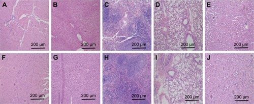 Figure 10 H&E stained tissue sections of major organs, including the heart (A and F), liver (B and G), spleen (C and H), lung (D and I), and kidney (E and J) from mice caudal vein injected with saline (A–E) or HNTs/DOX/LIP complexes (F–J) at day 14.Abbreviations: DOX, doxorubicin; HNTs, halloysite nanotubes.