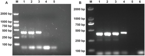 Figure 3 The effects of MWCNTs and MWCNT/PEI on the specificity of the nonspecific polymerase chain reaction system. Lane M is the DL 2000 marker, and the rightmost lane is negative control in each panel. (A) MWCNT was added into the polymerase chain reaction mixture. From lane 1 to 4, its final concentration is 0, 3.1, 6.2, and 12.4 mg/L, respectively. (B) MWCNT-PEI was added into the polymerase chain reaction mixture. From lane 1 to 5, its final concentration is 0, 23.6, 47.2, 94.2, and 188.8 μg/L, respectively.Abbreviations: MWCNTs, multiwalled carbon nanotubes; MWCNT/PEI, polyethyleneimine-modified multiwalled carbon nanotubes.