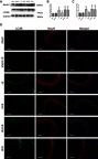 Figure 2 Autophagy markers expression level changes 24 hrs after HI suffering, SPC or rapamycin injection in each group. Representative western blots (A) and quantification of (B) Beclin1 and (C) LC3B-II, values are presented as mean±SD (n=6/group); **P<0.01 compared with the sham group; #P<0.05, and ##P<0.01 compared with the HI group; &P<0.05, and &&P<0.01 compared with the HI + S group. (D) Representative immunofluorescent staining of LC3B (green) with NeuN (red) in hippocampus, scale bar =100 μm. Group 1: Sham (sham surgery, control), group 2: Sham + SPC (sham + S), group 3: HI, group 4: HI + SPC (HI + S), group 5: HI + SPC + rapamycin (HI + S + R), group 6: HI + rapamycin (HI + R), group 7: HI + SPC + GSK126 (HI + S + G), group 8: HI + GSK126 (HI + G).Abbreviations: SPC, sevoflurane post-conditioning; HI, hypoxic ischemia.