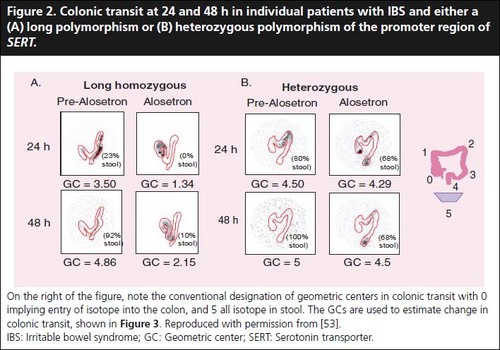 Figure 2. Colonic transit at 24 and 48 h in individual patients with IBS and either a (A) long polymorphism or (B) heterozygous polymorphism of the promoter region of SERT.