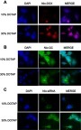 Figure 5 Cellular uptake of F2 (10% DOTAP) and F5 (30% DOTAP) DOX, QC and FAM-labeled siRNA-loaded nanoniosome formulations on AGS cell line. (A) Nio-DOX (B) Nio-QC (C) Nio-FAM-labeled siRNA (60x magnification).Abbreviations: DOTAP, 1, 2-dioleoyl-3-trimethylammonium-propane; Nio, niosomal; DOX, doxorubicin; QC, quercetin; DAPI, 4', 6-diamidino-2-phenylindole.