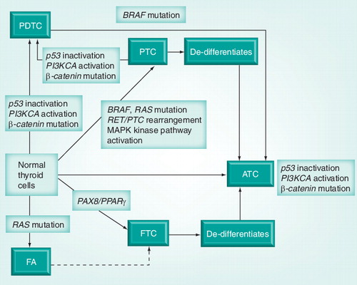 Figure 1. Anaplastic transformation is a multistep carcinogenetic process generated by three pathways.These three pathways are as follows: (1) A normal thyroid cell is transformed into PTC by BRAF or RAS mutation or RET/PTC rearrangement. Thyrocytes with BRAF mutation further de-differentiate into ATC. (2) PTC cells with p53 inactivation, PI3KA activation and β-catenin mutation have the ability to transform into PDTC. PDTC with a BRAF mutation can develop into ATC. (3) Normal thyrocytes with PAX8/PPARγ fusion or RAS mutation transform into FTC. Development of FTC from FA has been reported Citation[6,18]. Mutations of β-catenin, p53 inactivation and PI3KCA activation are seen in ATC.ATC: Anaplastic thyroid cancer; FA: Follicular adenoma; FTC: Follicular thyroid carcinoma; PDTC: Poorly differentiated thyroid cancer; PTC: Papillary thyroid cancer.