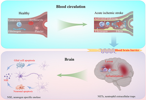 Figure 1 Inflammatory response in blood circulation and brain in acute ischemic stroke. Both circulating leukocytes and fibrinogen infiltrates into ischemic lesion through the damaged blood-brain barrier to aggravate the inflammatory reaction after stroke, while the NSE released by the injured neurons in the lesion flow into the peripheral circulation.