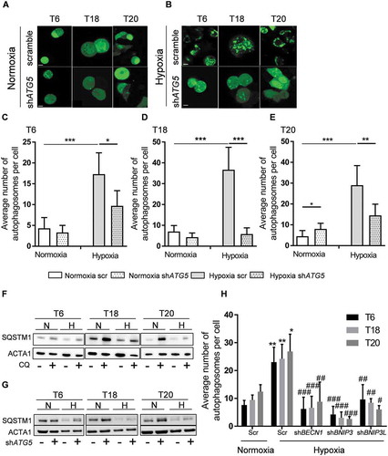 Figure 3. Hypoxia induces the formation of autophagosomes and autophagy inhibition via ATG5 knockdown decreases the number of autophagosomes in hypoxic TICs. (A-B) Control (scr) and ATG5-defective (shATG5) T6, T18 and T20-derived TICs were transfected with GFP-LC3 and cultivated in (A) normoxic and (B) hypoxic environments (overnight, at 0.1% oxygen level, see Material and Methods). Autophagosomes (green dot-like structures) were visualized by confocal microscopy. Images represent three independent experiments, scale bar: 5 µm. (C-E) Quantification of the number of autophagosomes in control (scr) and ATG5-defective (shATG5) patient-derived (C) T6, (D) T18 and (E) T20 TICs cultured under normoxia or hypoxia. (F) SQSTM1 protein expression in normoxic (N) and hypoxic (H) TICs after the addition of chloroquine. Western blot images are representative of two independent experiments. (G) SQSTM1 protein expression in ATG5-defective (+) and scramble (-) TICs under normoxia (N) or hypoxia (H). Western blot images are representative of two independent experiments. (H) Detection and quantification of autophagosomes in TICs after BECN1, BNIP3, and BNIP3L knockdown. For the quantification of autophagosomes (C-E and H), ten cells were counted for each condition and the average number of autophagosomes was reported. Statistically significant differences are shown as *p < 0.05, **p < 0.01, ***p < 0.001. Figures displayed are representative figure of at least two independent experiments per TIC culture for C-E and H. In H, * represents statistical analysis between normoxia and hypoxia, whereas # represents the statistical analysis between the hypoxic scramble condition and the shBNIP3, shBNIP3L, and shBECN1 conditions.