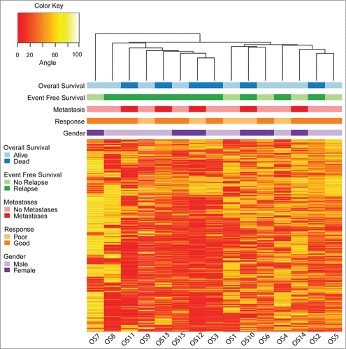 Figure 1. Unsupervised hierarchical clustering and heatmap of osteosarcoma samples based on DNA methylation values using 10,000 random loci chosen from among the 10 percent most variable autosomal loci (standard deviation >27 ). Clinical correlates are plotted above the heatmap. The clustering pattern is similar to the hierarchical clustering obtained using all 1.1 million evaluable loci from HELP-tagging and segregates the samples into 2 main groups, with one group composed solely of samples from patients who would experience disease relapse.