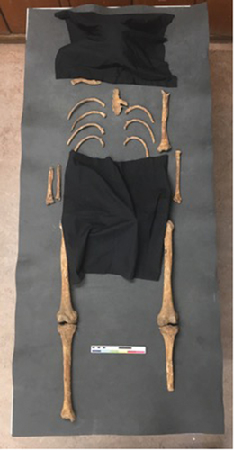 Figure 4. The skeletal remains to be examined by participants. Two small black sheets covered the skull and the innominates. A large black sheet was placed on top of this prior to participants entering the room and would be removed by the invigilator prior to the start of the examination.