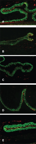 Figure 4 Labeling of tight junctional proteins in conjunctiva. Immunofluorescent staining of ZO-1 (red) and E-cadherins (green) in tissue sections from five treatment groups. A) No sensitization, no challenge (naïve animals); B) Sensitized, challenged; C) Sensitized, challenged, drug vehicle only; D) Sensitized, challenged, 0.1% topical olopatadine; E) Sensitized, challenged, 0.025% topical alcaftadine. Note decreased staining in sensitized, challenged animals without drug treatment (B and C).