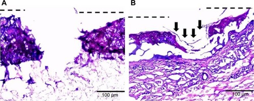 Figure 10 Hematoxylin and eosin stained images of ex vivo partial thickness wound model in porcine ear skin.Notes: (A) Alginate control and (B) alginate hydrogel/nZnO (1%) composite bandages. Arrows indicate the re-epithelialization.Abbreviation: nZnO, zinc oxide nanoparticles.