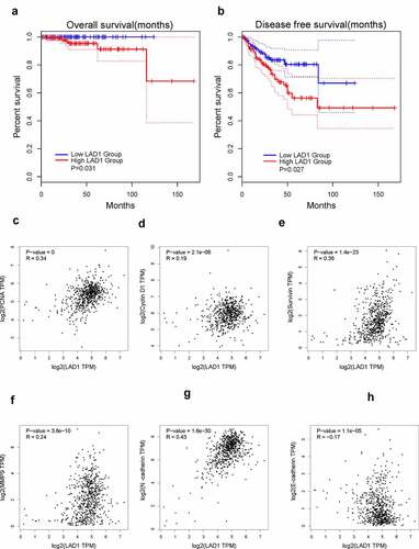 Figure 4. High expression of LAD1 was associated with adverse outcomes in PCa patients. (a) Kaplan–Meier method and log-rank test were performed to analyze the relationship between LAD1 expression level and overall survival (OS). (b) Kaplan–Meier method and log-rank test were performed to analyze the relationship between LAD1 expression level and disease-free survival (DFS). (c–h) Pearson correlation coefficient analysis was performed to examine the correlation between LAD1 expression level and genes involved in cell proliferation and EMT