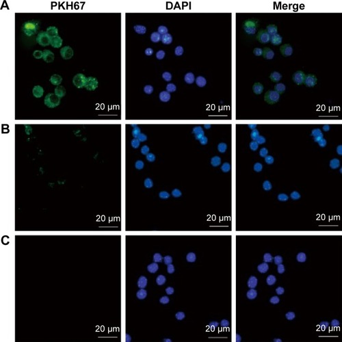 Figure 2 Uptake of Toxoplasma gondii exosomes by macrophages.Notes: Ten micrograms of the (A) PKH67-labelled T. gondii exosomes, or (B) PKH67-PBS control, or (C) PBS control alone were added to the macrophages and incubated at 37°C for 2 h. In the fluorescence microscopy pictures, PKH67 was used to label the exosomes (green) and DAPI was used to detect the nucleus of the macrophages (blue). Results are representative of three independent experiments.Abbreviations: PBS, phosphate buffered saline; DAPI, 4′,6-diamidino-2-phenylindole.