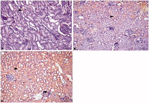 Figure 5. Immunohistochemical staining of caspase-9 in rat kidney (200×). (A) HRs showed slight immunopositivity in intertubular areas, (B) DRs showed moderate immunopositivity in tubular cells (arrowhead) and glomeruli (arrow), and (C) DRs + CN showed severe immunopositivity for caspase-9 in tubular cells (arrowhead) and glomeruli (arrow).