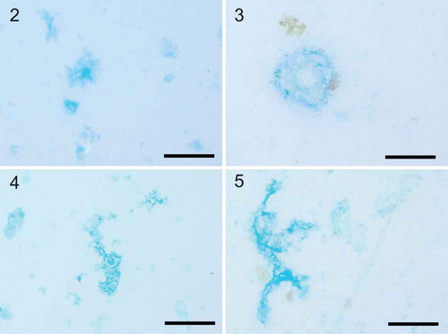 Figs 2–5. Exopolymer particles observed in diatom cultures and the Pacific Ocean. Exopolymer particles were collected using gentle filtration onto 0.4 µm polycarbonate filters and stained. 2. Coomassie brilliant blue staining particles (CSP) in a culture of Thalassiosira weissflogii. 3. CSP particles from the surface Pacific Ocean collected off the coast of Oregon during July 2011. 4. Transparent exopolymer particles (TEP) in a culture of Thalassiosira weissflogii. 5. TEP particles from the surface Pacific Ocean collected off the coast of Oregon during July 2011. TEP were stained with Alcian blue according to Alldredge et al. (Citation1993) and CSP were stained according to Long & Azam (Citation1996). Scale bars = 100 µm.