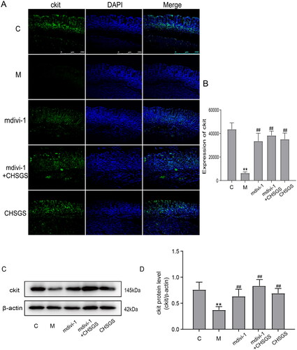 Figure 2. Expression of ckit in FD rats detected by Immunofluorescence and Western Blot. (A) Immunofluorescence. (B) Results of ckit Immunofluorescence. (C) Western Blot. (D) Results of ckit Western Blot. Data were presented as means ± SD, compared with C, **p < 0.01, compared with M, ##p < 0.01.
