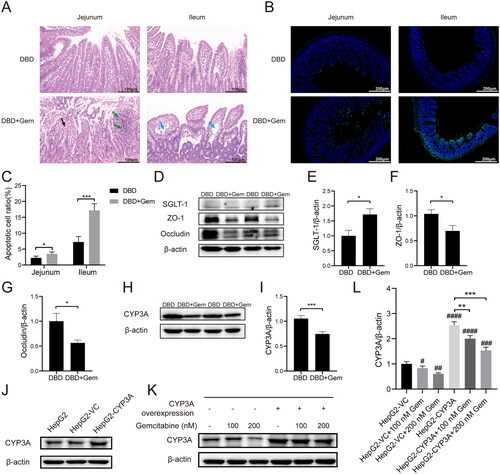 Figure 5. Gemcitabine treatment increased intestinal permeability, up-regulated the expression of SGLT-1, and down-regulated ZO-1, occludin and CYP3A. Haematoxylin–eosin staining histopathological evaluation of jejunum and ileum (A). The microscopic scale bar represents 100 μm. Typical fluorescence images of TUNEL staining in rats’ jejunal and ileal epithelium (B). The scale bar represents 200 μm. The percentage of apoptotic cells in the intestinal endothelial cells of rats (C). *p < 0.05, ***p < 0.001, jejunum vs. ileum. The expressions of SGLT-1, ZO-1 and occludin in the small intestine tissues (D–G). The expression level of CYP3A enzyme in the liver tissues (H, I). *p < 0.05, vs. DBD, ***p < 0.001, vs. DBD. CYP3A was introduced into HepG2 cells, and the overexpression efficacy was confirmed by western blot (J). Western blot typical bands of CYP3A and internal reference β-actin in transfected HepG2 cells (K). The CYP3A/β-actin ratio of HepG2 cells and the overexpression of CYP3A can block the down-regulation of CYP3A expression caused by gemcitabine (L). #p < 0.05, vs. HepG2-VC, ##p < 0.01, vs. HepG2-VC, ###p < 0.001, vs. HepG2-VC, ####p < 0.0001, vs. HepG2-VC, **p < 0.01, vs. HepG2-CYP3A, ***p < 0.001, vs. HepG2-CYP3A. The data were expressed as mean ± SEM (n = 6).