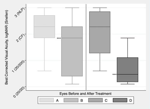 Figure 2 Box plots representing best-corrected visual acuity before and after intervention with intra-arterial tPA for CRAO. In A and B (left), results are from all eyes (n=15) that received intervention. In C and D (right), results are from the subset of eyes (n=8) with improvement of 3 or more lines of Snellen visual acuity improvement, demonstrating the magnitude of visual improvement in cases of successful treatment. Statistical testing was done using logMAR values. ***statistical significance, p<0.05.