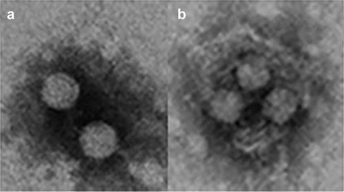 Figure 2. HAV exists in a dual phenotype. (a) Naked virions are shed in the feces of infected patients and are responsible for the fecal host-to-host transmission (b). Quasi-enveloped virions are present in the blood and are responsible for the cell-to cell transmission and occasionally parenteral host-to-host transmission. These images were obtained in our lab from supernatants of HuH7 cells infected with the HM175-43 c strain of HAV