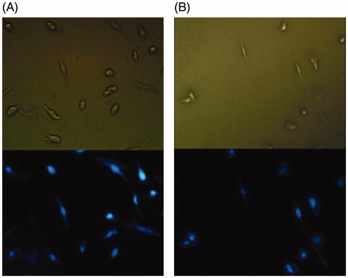 Figure 5. Microscopic images of DAPI-stained H9c2 cells following a 72 h exposure by (A) free curcumin and (B) curcumin-NIPAAM-MAA nanoparticles. The figures indicated that free curcumin and curcumin-NIPAAM-MAA nanoparticles did not show significant chromatin degradation in H9c2 cells.