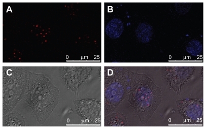 Figure 6 Colocalization of polycation lipid nanocarrier/DNA complexes (PDC) (N/P = 10) with nucleus in human lung adenocarcinoma (SPC-A1) cells under laser scanning confocal microscopy at 6 hours after transfection. (A) TM-Rhodamine labeled plasmid DNA (red); (B) Hoechst 33258 labeled nuclei (blue); (C) phase-contrast image of SPC-A1 cells; (D) merged image, scale bar = 25 μm.