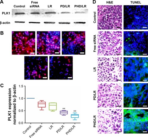 Figure 9 Ex vivo PLK1 expression detected using WB (A) and IF (B), respectively. PLK1 expression was also quantified (C). Tumor tissues were used to prepare paraffin-embedded slides for H&E and TUNEL study (D).Notes: **P<0.01, scale bars represent 50 µm.Abbreviations: IF, immunofluorescence; LR, lipoplex; mPEG, methoxy poly(ethylene glycol); PD, PHis-PSD; PHD, mPEG-PHis-PSD; PHis, poly(histidine); PSD, poly (sulfadimethoxine); WB, Western blotting.