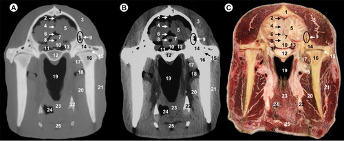 Figure 4. (A) Bone window CT image, (B) soft-tissue window CT image and (C) anatomic section at the level of mesencephalon.All views are rostral. 1, parietal bone; 2, dorsal sagittal sinus; 3, temporal muscle; 4, cerebral longitudinal fissure; 5, cerebral hemisphere; 6, third ventricle; 7, mesencephalic tectum; 8, mesencephalic aqueduct; 9, temporal sinus; 10, cerebral peduncle; 11, subarachnoid space; 12, body of basisphenoid bone; 13, ophthalmic, abducens, trochlear and oculomotor nerves; 14, zygomatic process of temporal bone; 15, temporomandibular joint; 16, condylar process of mandible; 17, lateral pterygoideus muscle; 18, maxillary vein; 19, pars nasalis pharyngis; 20, medial pterygoideus muscle; 21, masseter muscle; 22, hyoid bone; 23, pharyngeal muscles; 24, pars oralis pharyngis; 25, epiglottis.