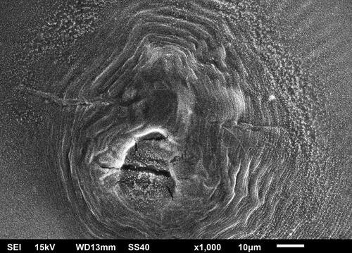Figure 2. Scanning electron microscopy displays perineal arrangement of M. incognita, characterized by an extensive rounded dorsal arches and prominent undulating striations.