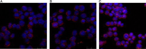 Figure 9. Expression levels of Bcl-2 in KM3 cells as assessed by laser confocal fluorescence microscopy. (A) The KM3 group. (B) The KM3/hUCBDSC co-culture group. (C) The KM3/MM-BMSC co-culture group. After sub-culture for 4 days, KM3 cells from each of the three groups were collected, and the expression of Bcl-2 was examined by laser confocal fluorescence microscopy. The expression of Bcl-2 in KM3 cells from the KM3/hUCBDSC group was lower than that observed in the KM3/MM-BMSC group. Each experiment was performed three times. hUCBDSCs, human umbilical cord blood-derived stromal cells; MM-BMSCs, multiple myeloma bone marrow stromal cells.