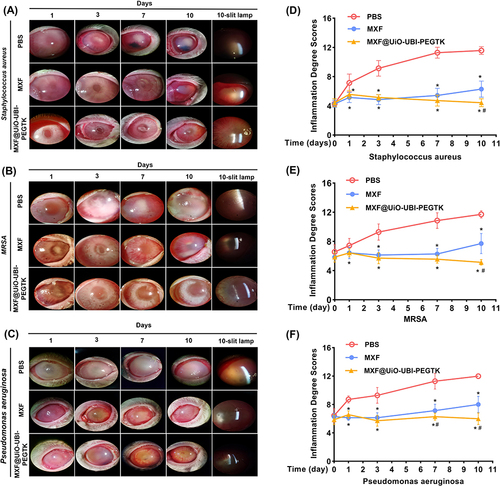 Figure 7 Evaluation of the antibacterial effects in vivo. Diffuse and slit lamp micrographs as well as the inflammation degree in corresponding endophthalmitis induced by (A and D) S. aureus, (B and E) MRSA, and (C and F) P. aeruginosa upon treatment with PBS, MXF, and MXF@UiO-UBI-PEGTK for 1, 3, 7, and 10 d, respectively (*p, #p < 0.05) (*p, MXF or MXF@UiO-UBI-PEGTK vs PBS; #p, MXF vs MXF@UiO-UBI-PEGTK).