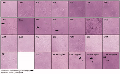 Figure 5. Representative images (20×) for changes observed in cell morphology of M12.C3.F6 (murine B-cell lymphoma) after treatment with seaweed extracts (100 μg/mL) and concentration effect of acetone extract of C. sertularioides (CsA). Code images: XxY, where Xx = seaweeds species (Ue, U. expansa; Cs, C. sertularioides; Rr, R. riparium; Sf, S. filamentosa; Pd, P. durvillaei; Ci, C. isabelae; and Gv, G. vermiculophylla) and Y = type of extract (H, hexane; A, acetone; M, methanol) CU1 and CU2: Are untreated controls, with DMSO used in the screening and CsA treatment, respectively.