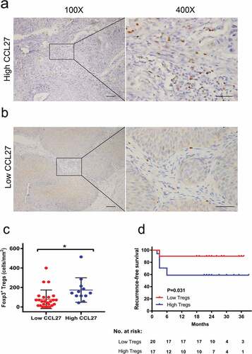 Figure 4. Association between serum CCL27 and regulatory T cells (Tregs) in the tumor microenvironment.