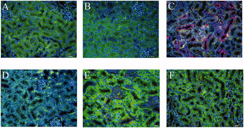 Figure 6. Expression of p-RIPK3 in RTEC of TCE-sensitized mice by immunofluorescence. (A) Blank control, (B) Vehicle control, (C) TCE+, (D) TCE−, (E) TCE + R7050+ group, (F) TCE + R7050− group. Red: p-RIPK3; Green: CK-18; Blue: DAPI. Magnification 400×. Scale bars = 50 μm.