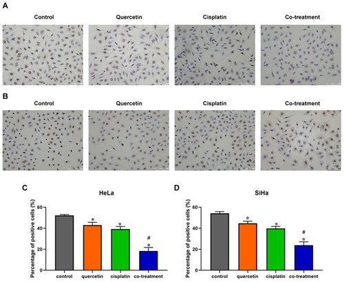 Figure 2 The effects of quercetin combined with cisplatin on the cell proliferation in cervical cancer cells. HeLa (A) and SiHa (B) cells were treated with control (complete culture medium), quercetin (15 μM for HeLa and 30 μM for SiHa), cisplatin (10 μM for HeLa and 12 μM for SiHa) or the co-treatment of quercetin and cisplatin. The ratios of cell proliferation were assessed by BrdU assay. The bars represent the ratios of cell proliferation in each group. Data of HeLa (C) and SiHa (D) are expressed as means ± SD deviation of three independent experiments. *P < 0.05 vs control group, #P < 0.05 vs cisplatin group.